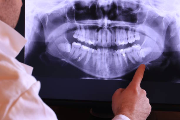Best Emergency Denture Repair in Yukon, OK